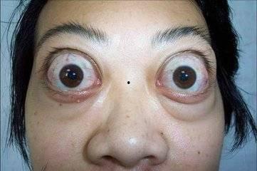 吃瓜捏爆眼球视频下载免费,轻松获取热门内容！  第2张